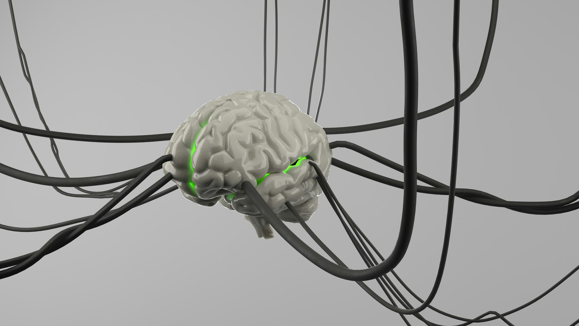 A computer generated image of a brain surrounded by wires